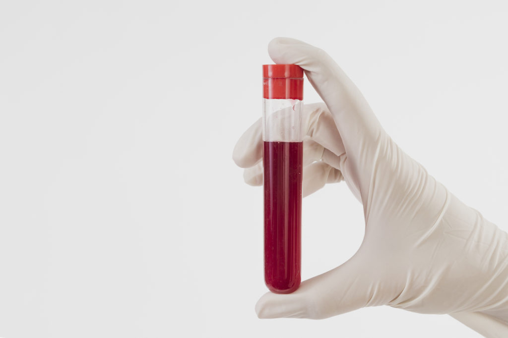 Blut in einem Reagenzglas