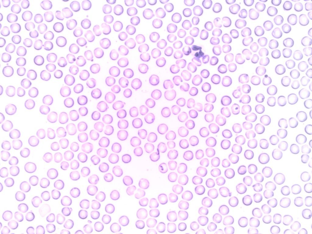Weiße Blutkörperchen